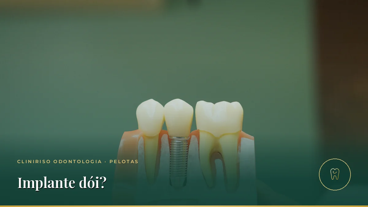 Implante Dentário
